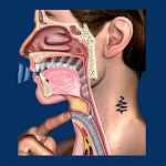 Laryngectomy For PC Windows
